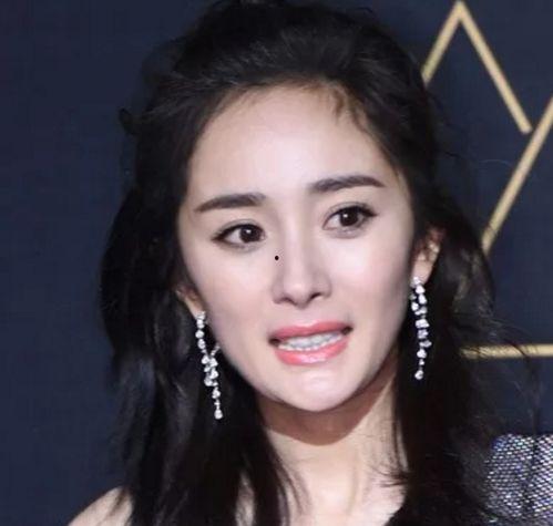 身体皮肤不好的明星,肌肤逆袭之路